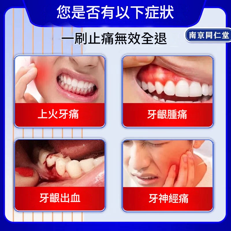 牙痛寧止疼噴霧劑智齒牙齦上火腫痛快速消炎止痛殺牙神經專用藥水